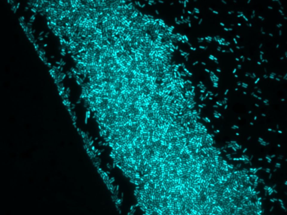 Bacterial cells under fluorescence microscope